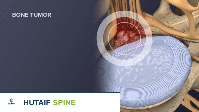 الألم العصبي: دليل شامل للتشخيص والعلاج والتعافي مع الأستاذ الدكتور محمد هطيف في صنعاء