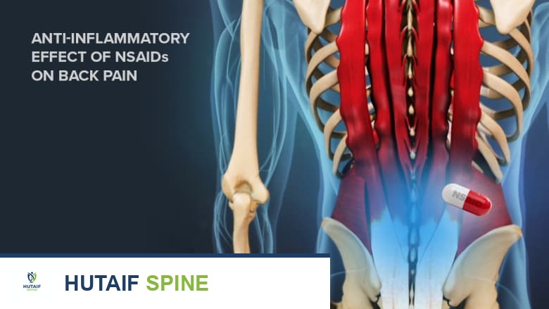تأثير مضادات الالتهاب غير الستيرويدية على آلام الظهر
