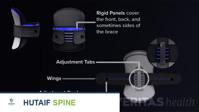 توضيح طبي لدعامة صلبة وأجزائها المختلفة مُبرزة
