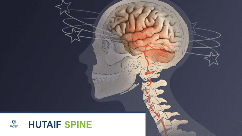 دليلك الشامل لمركب CBD (الكانابيديول) وتأثيره على آلام الظهر: رؤية الأستاذ الدكتور محمد هطيف