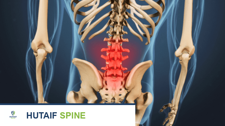 Posterior view of the lumbar spine highlighting pain.