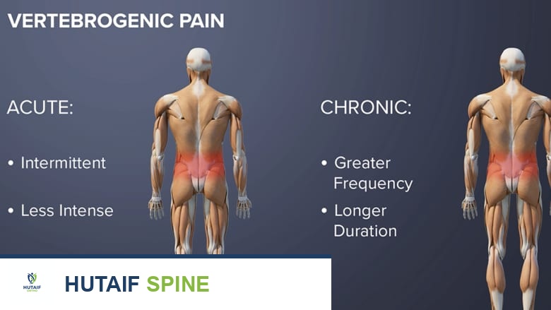 صورة توضيحية لـ الألم الفقري المنشأ كل ما تحتاج لمعرفته من الأسباب إلى العلاج مع الأستاذ الدكتور محمد هطيف