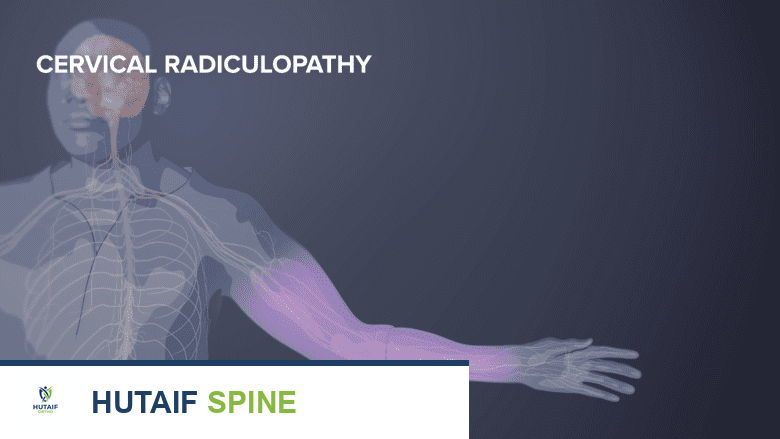 ألم وتنميل اليد: الأسباب، الأعراض، التشخيص، والعلاج الشامل مع الأستاذ الدكتور محمد هطيف