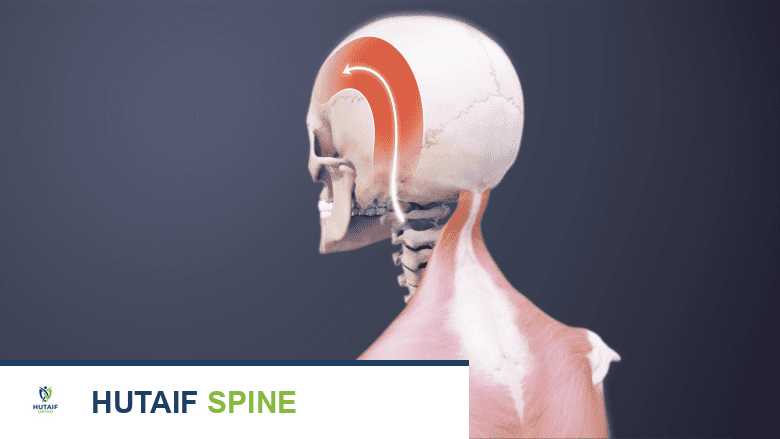 illustration showing occipital neuralgia pain.