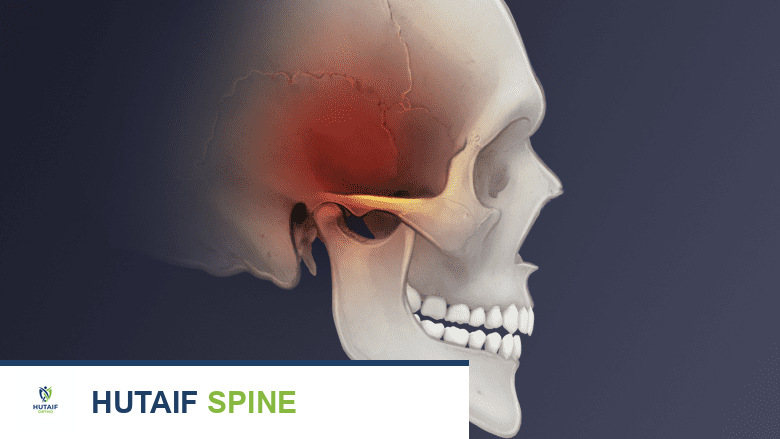 آلام الرقبة والصداع: دليل شامل للأسباب، الأعراض، والتشخيص والعلاج مع الدكتور محمد هطيف