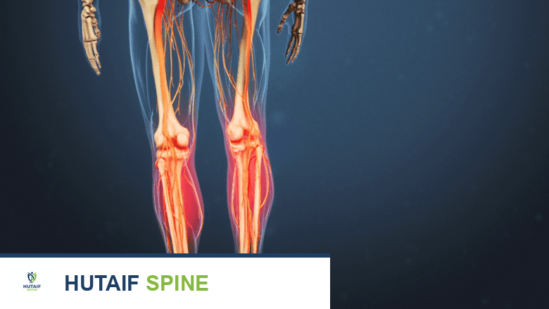 متلازمة الكمثري كل ما تحتاج معرفته عن آلام الأرداف وعرق النسا الكاذب