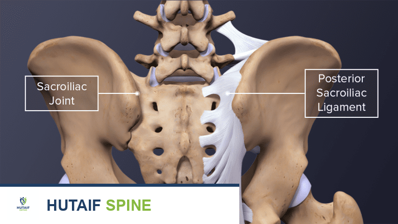 حقن البرولوثيرابي لعلاج آلام الظهر المزمنة: دليل شامل من الأستاذ الدكتور محمد هطيف