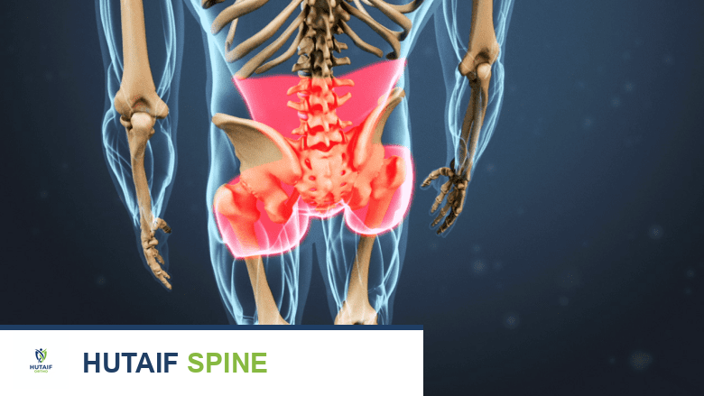 تسليط الضوء الأحمر على منطقة أسفل الظهر والأرداف يوضح الألم المحوري في الظهر.