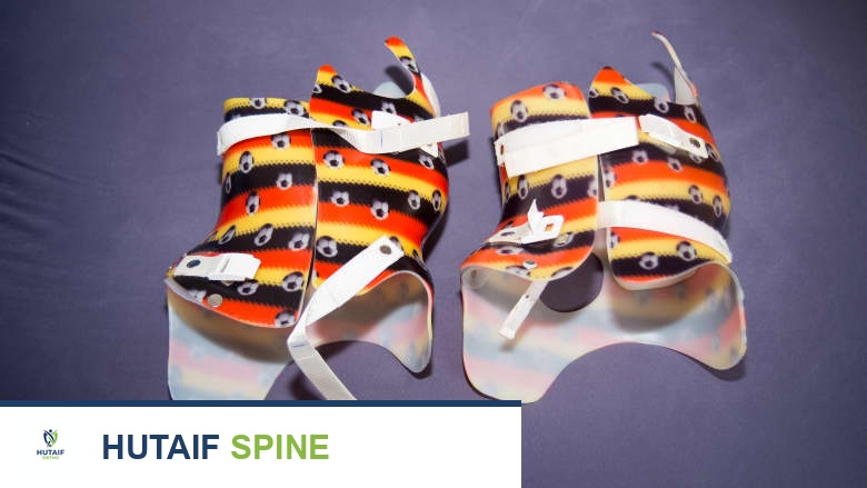 الجنف لدى المراهقين: تحديات دعامة الظهر وكيفية التغلب عليها لضمان عمود فقري صحي مع الأستاذ الدكتور محمد هطيف