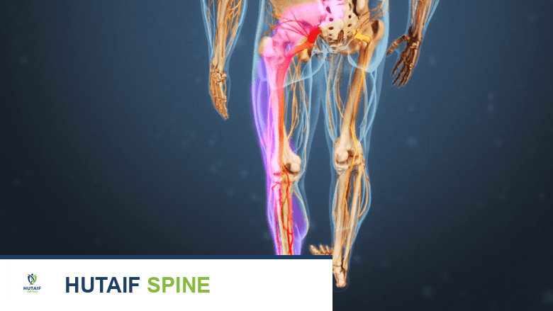 رسم توضيحي يظهر الجزء السفلي من جسم شخص بالغ مع تسليط الضوء على ساق واحدة باللون الوردي.