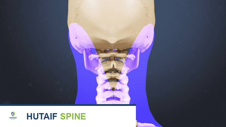 إصابات الرقبة الارتدادية: الأعراض، التشخيص، والعلاج الشامل مع الأستاذ الدكتور محمد هطيف في صنعاء