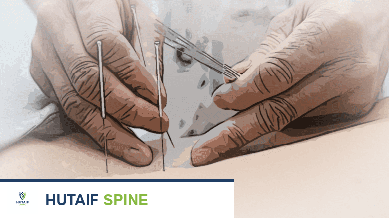 صورة توضيحية لـ علاج إصابة الرقبة الارتدادية (الويبلش) والتعافي منها: دليل شامل من الأستاذ الدكتور محمد هطيف
