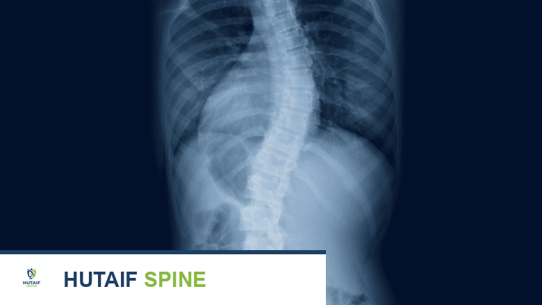 الأشعة السينية للعمود الفقري: دليل شامل لفهم تصوير الظهر والرقبة