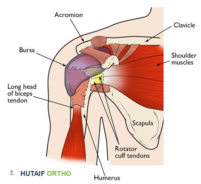 صورة توضيحية لـ انحشار الكتف والتهاب أوتار الكفة المدورة: دليل شامل للتشخيص والعلاج مع الأستاذ الدكتور محمد هطيف في صنعاء