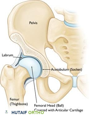 خلع الورك: دليل شامل للمرضى من الأستاذ الدكتور محمد هطيف