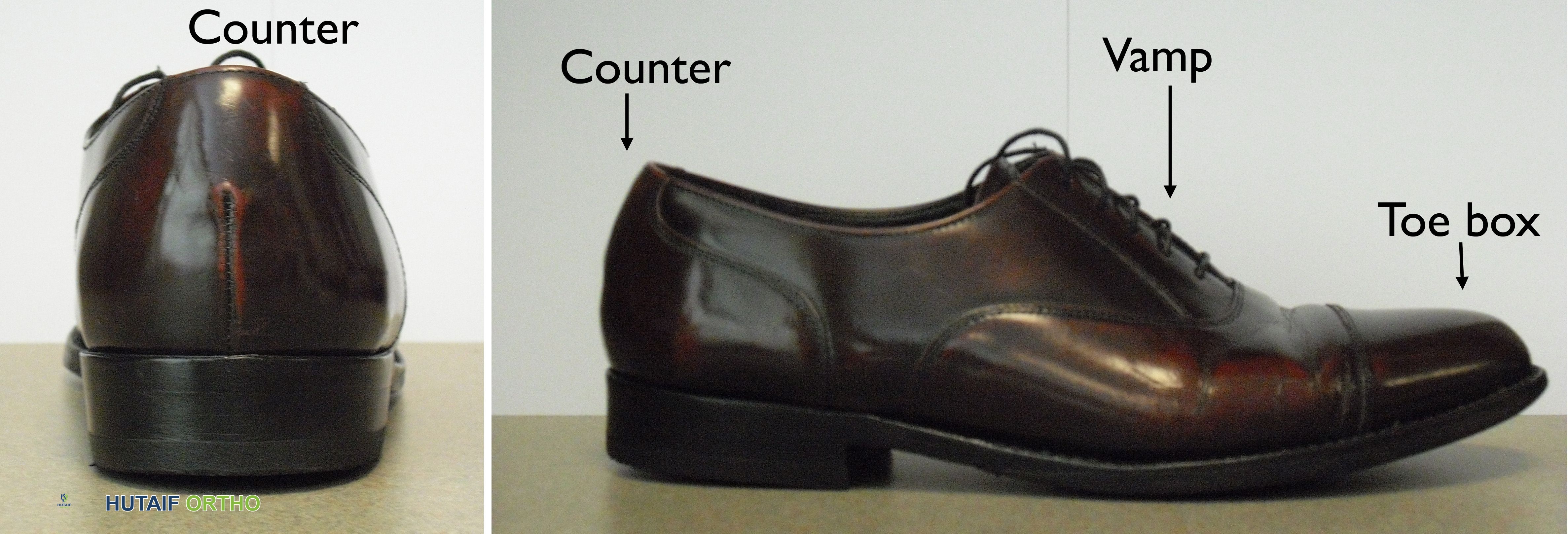 صورة توضيحية لـ الأحذية المناسبة لصحة قدميك وجسمك: دليلك الشامل من الأستاذ الدكتور محمد هطيف في صنعاء