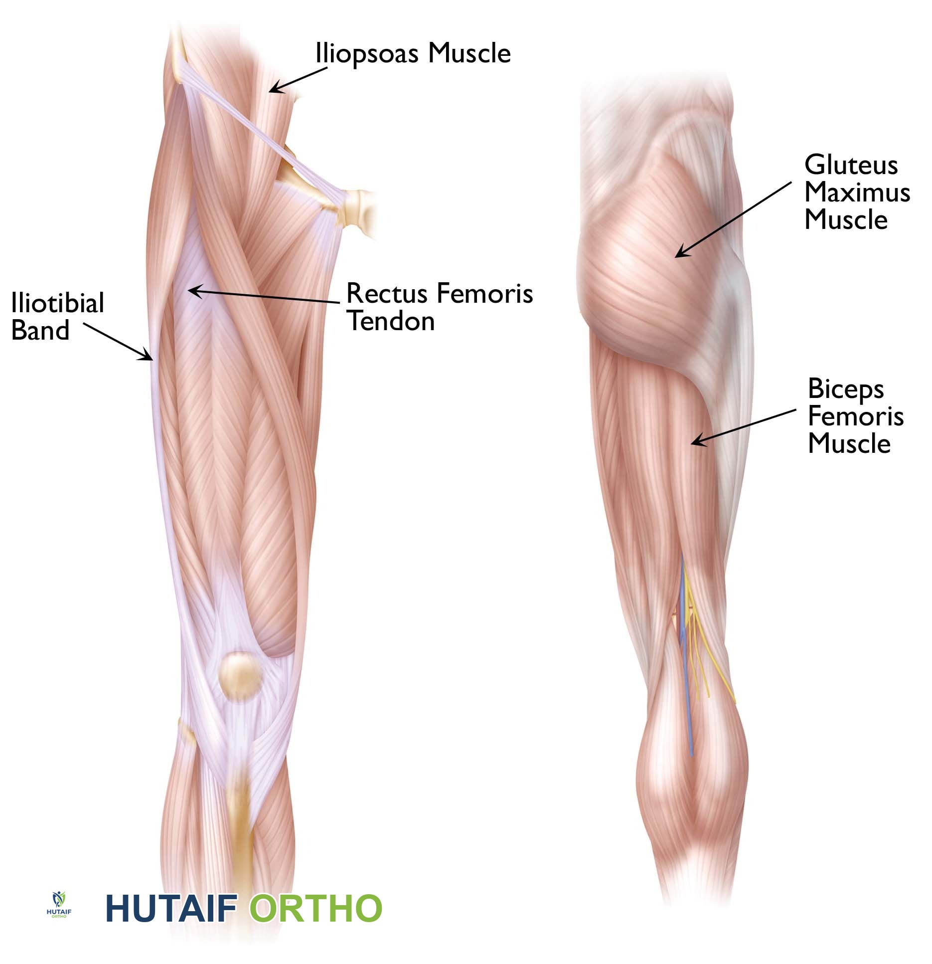 صورة توضيحية لـ الورك الطاطئ أسباب طقطقة الورك وعلاجاتها مع الأستاذ الدكتور محمد هطيف