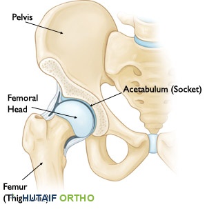 صورة توضيحية لـ خشونة المفاصل: دليل شامل للتشخيص والعلاج والتعافي مع الأستاذ الدكتور محمد هطيف