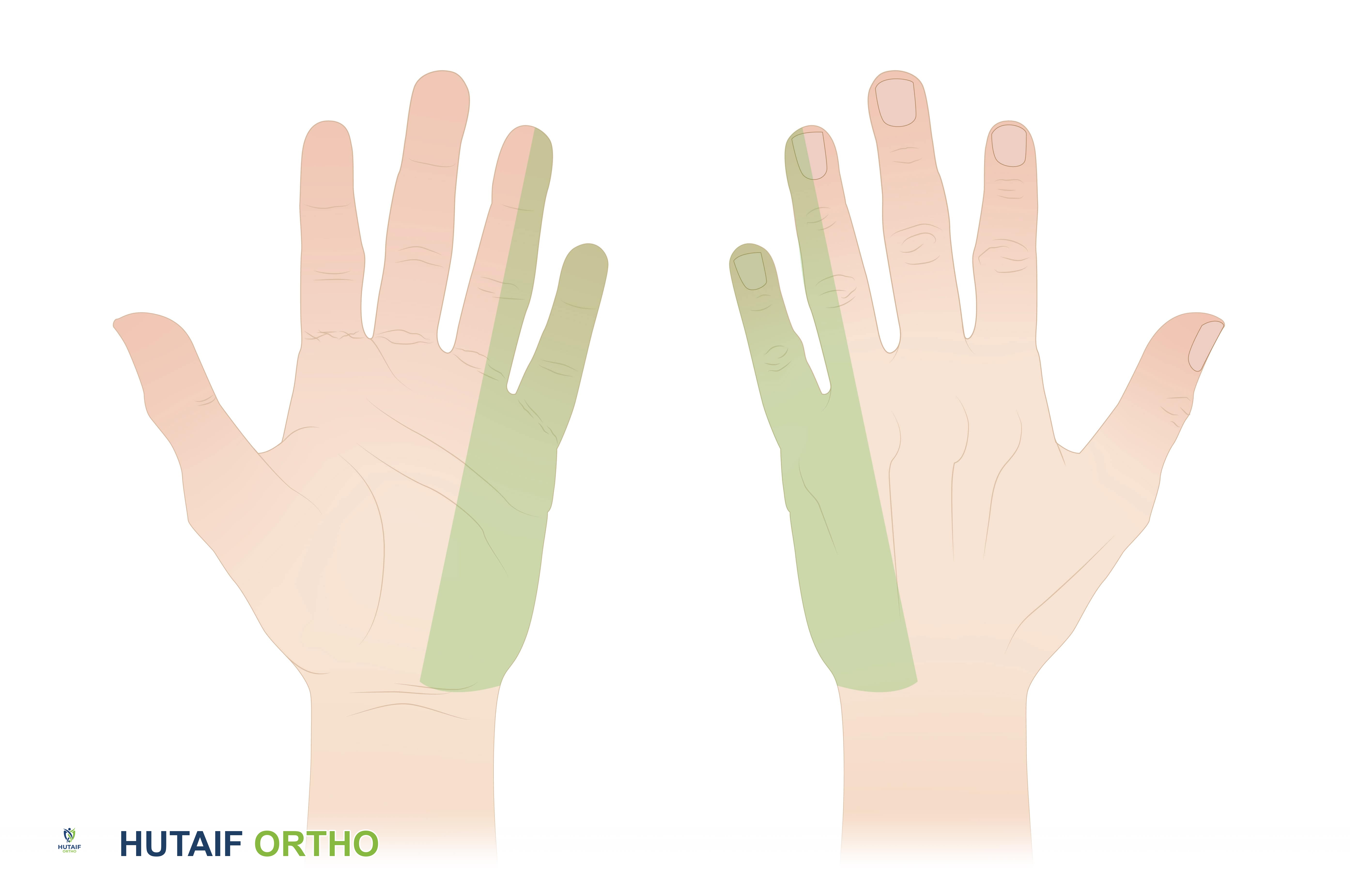 منطقة الإحساس من العصب الزندي