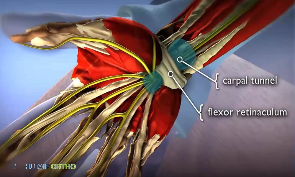 صورة توضيحية لـ برنامج التمارين العلاجية لمتلازمة النفق الرسغي: دليل شامل لاستعادة راحة يدك وحركتها مع الأستاذ الدكتور محمد هطيف