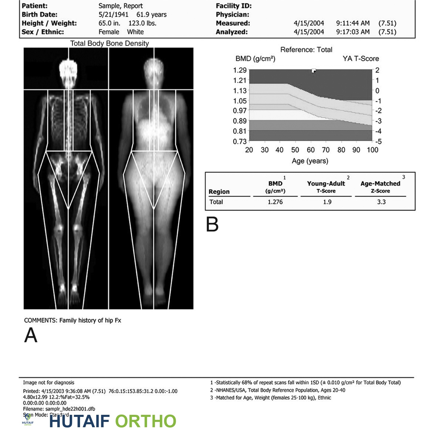 صحة العظام في كل مرحلة عمرية: دليلك الشامل مع الأستاذ الدكتور محمد هطيف