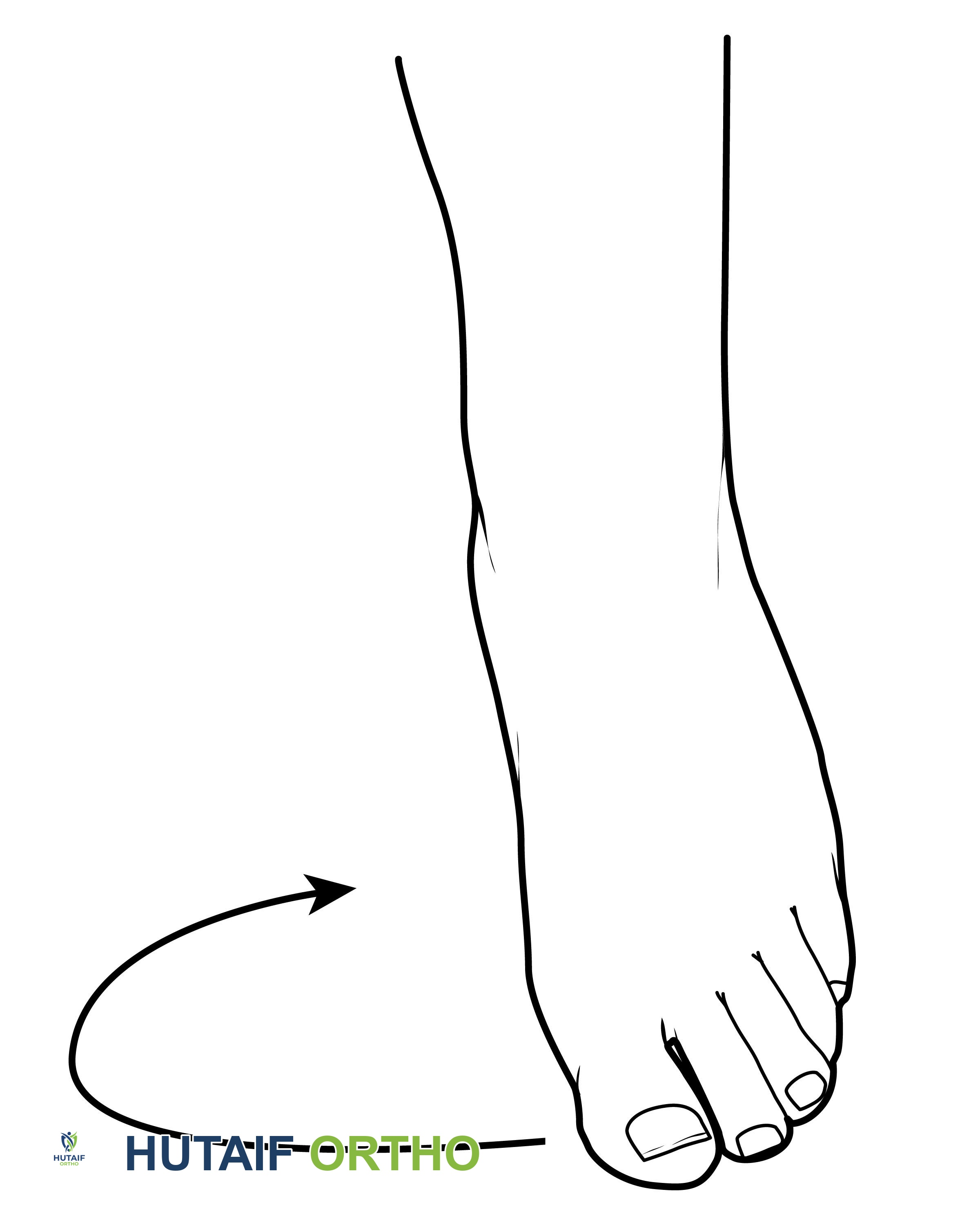 صورة طبية: برنامج شامل لتقوية وتأهيل القدم والكاحل: دليلك للتعافي في صنعاء مع الأستاذ الدكتور محمد هطيف