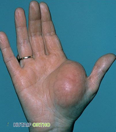 وصف طبي دقيق للمريض