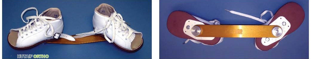 دعامة ماركيل لإبعاد القدم