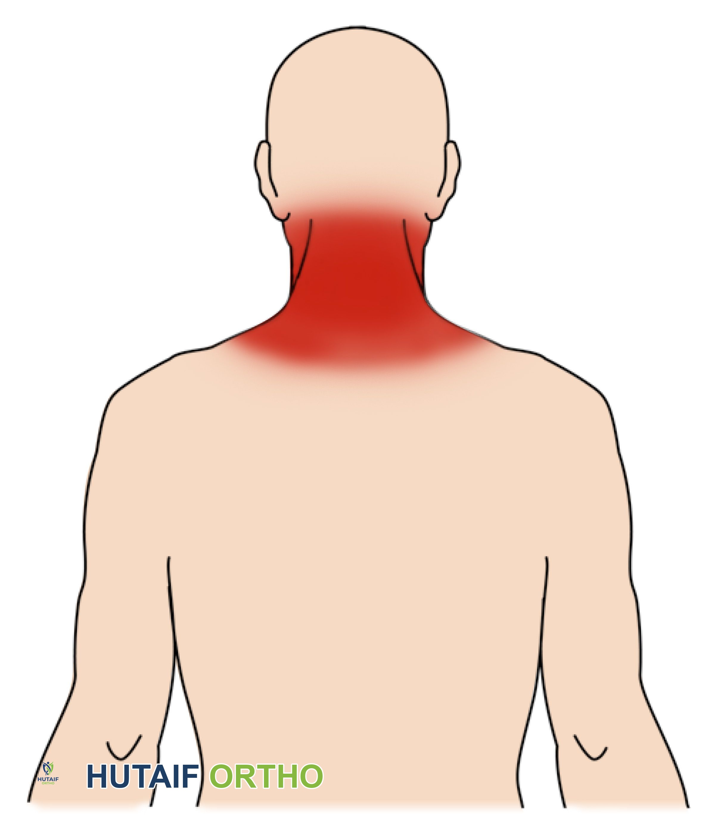 التواء وشد الرقبة: دليل شامل للعلاج والتعافي مع الأستاذ الدكتور محمد هطيف