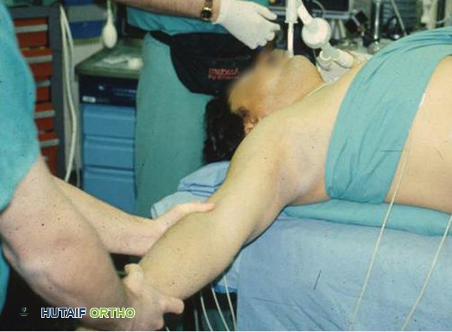 صورة توضيحية لـ اضطرابات المفصل القصي الترقوي: دليلك الشامل للعلاج والتعافي مع الأستاذ الدكتور محمد هطيف