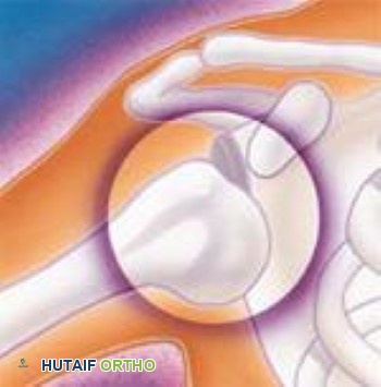 إصابات الكتف: دليل شامل لكسور وخلوع الكتف مع الأستاذ الدكتور محمد هطيف
