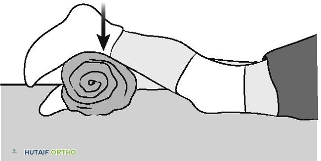 تقلص العضلة الرباعية