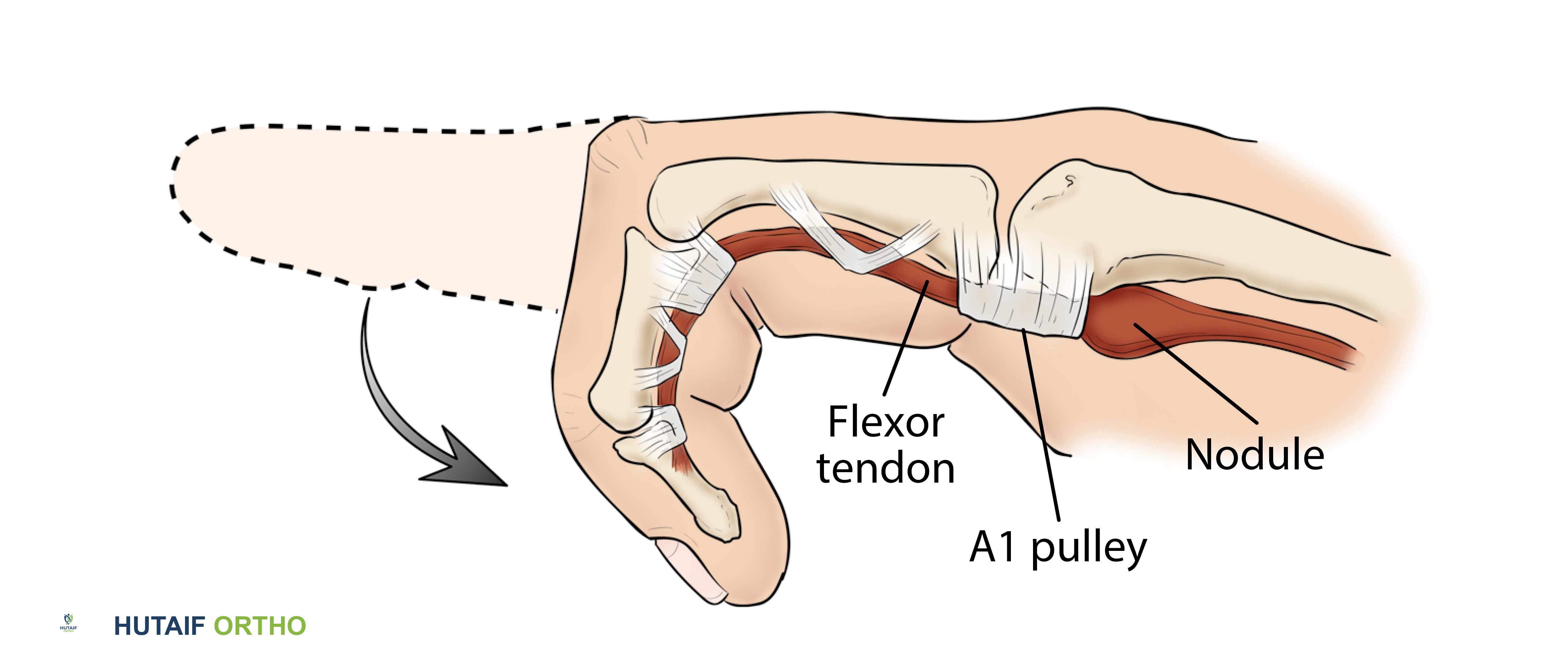 وصف طبي دقيق للمريض
