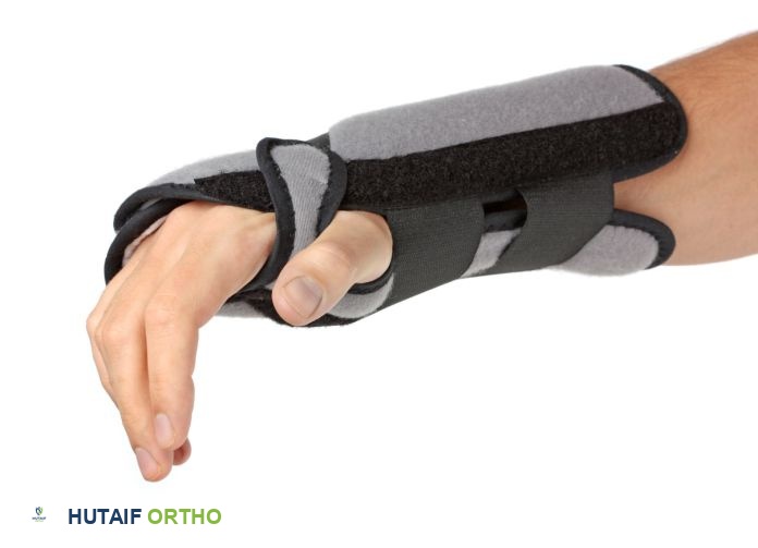 صورة توضيحية لـ التواء الرسغ: دليلك الشامل للتشخيص والعلاج والتعافي مع الأستاذ الدكتور محمد هطيف