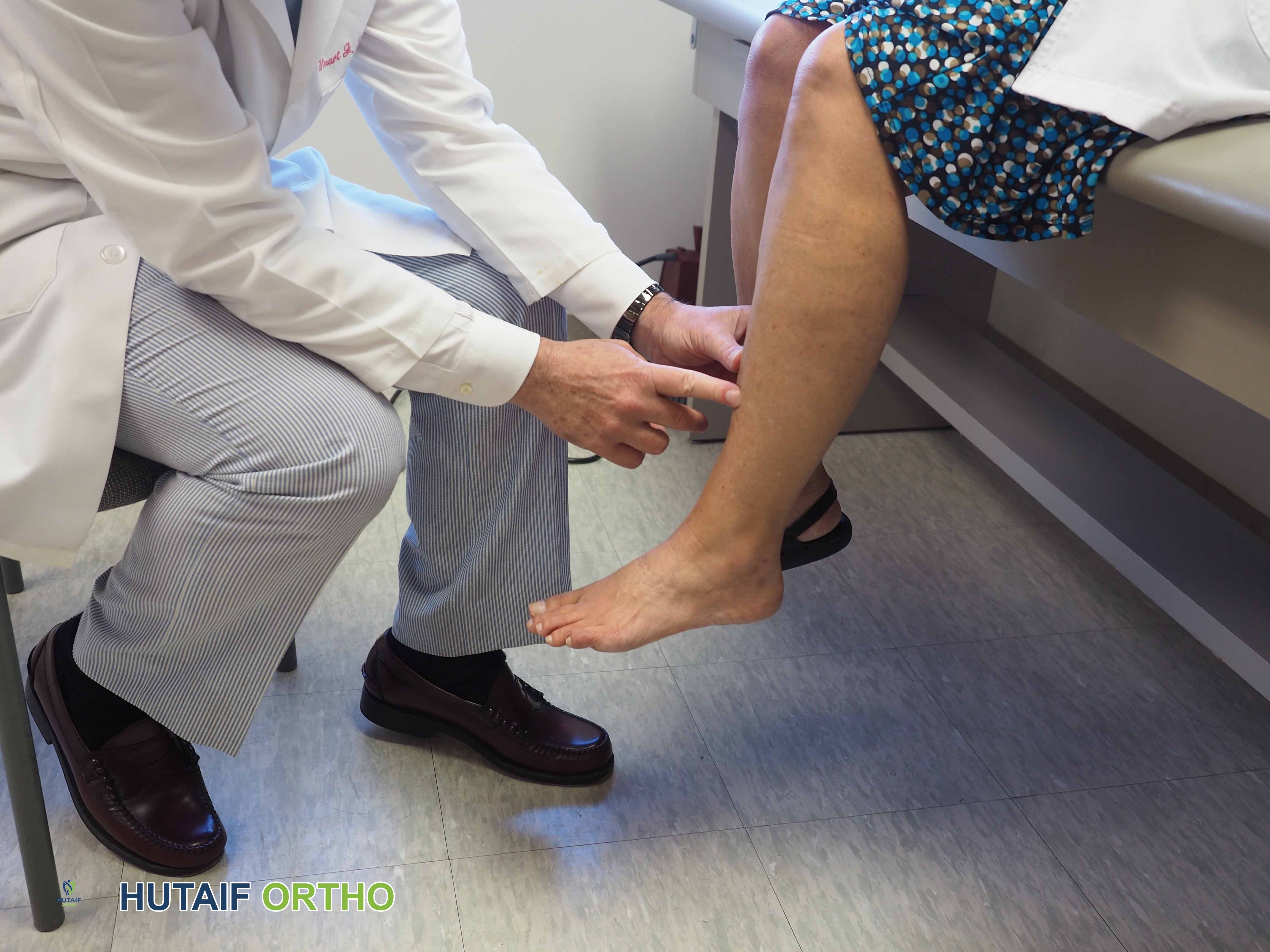 صورة توضيحية لـ جبائر قصبة الساق (ألم الساق الأمامي): دليل شامل من الألف إلى الياء