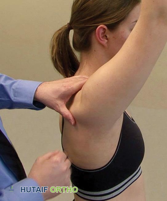 صورة توضيحية لـ انحشار الكتف والتهاب أوتار الكفة المدورة: دليل شامل للتشخيص والعلاج مع الأستاذ الدكتور محمد هطيف في صنعاء