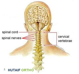 صورة توضيحية لـ ألم الرقبة: دليل شامل من الأستاذ الدكتور محمد هطيف لمرضى صنعاء