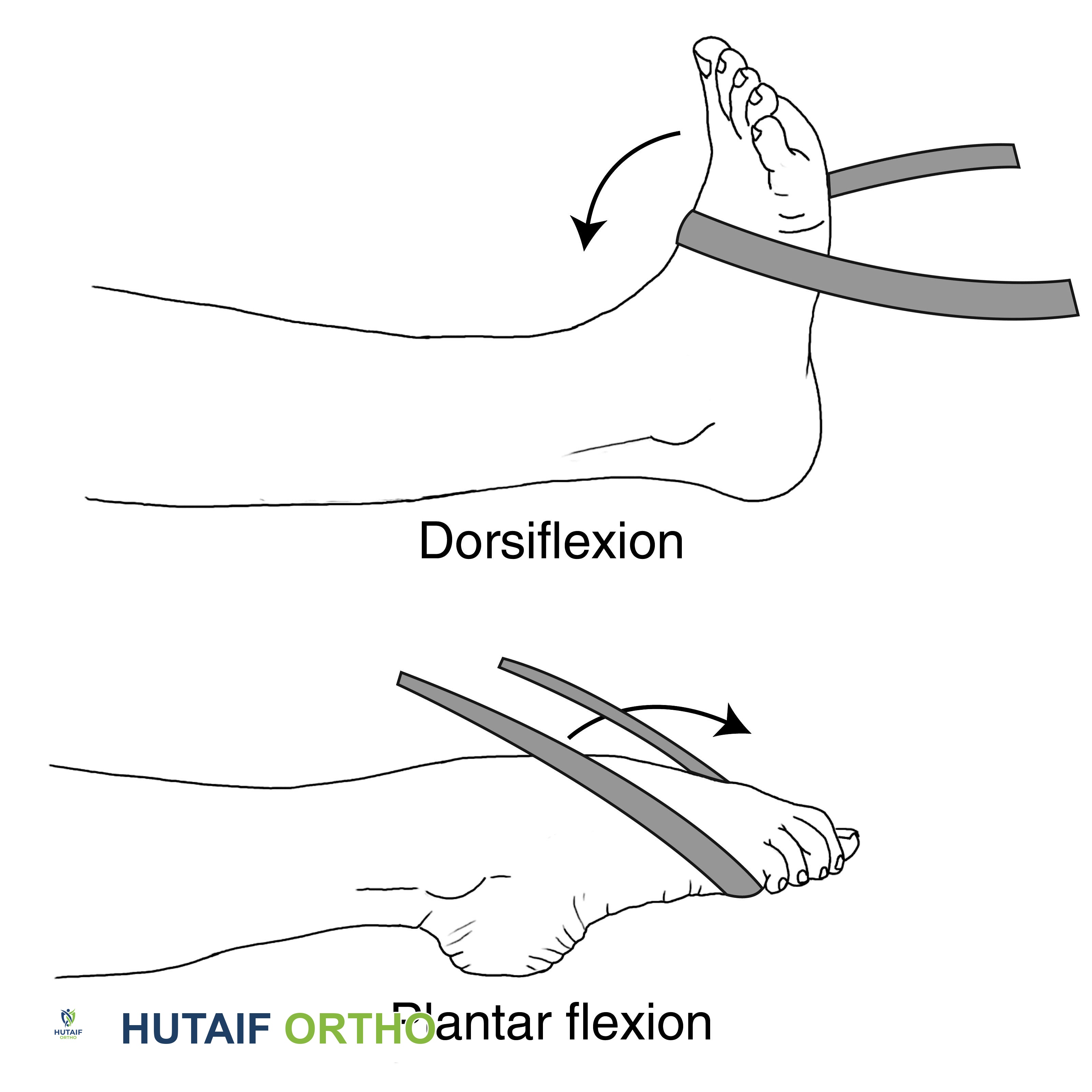صورة طبية: برنامج شامل لتقوية وتأهيل القدم والكاحل: دليلك للتعافي في صنعاء مع الأستاذ الدكتور محمد هطيف