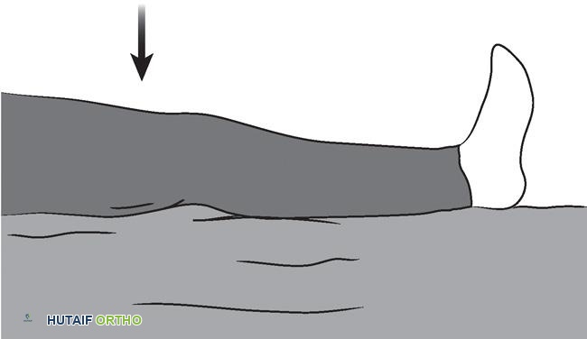 توضيح لتمارين شد العضلة الرباعية