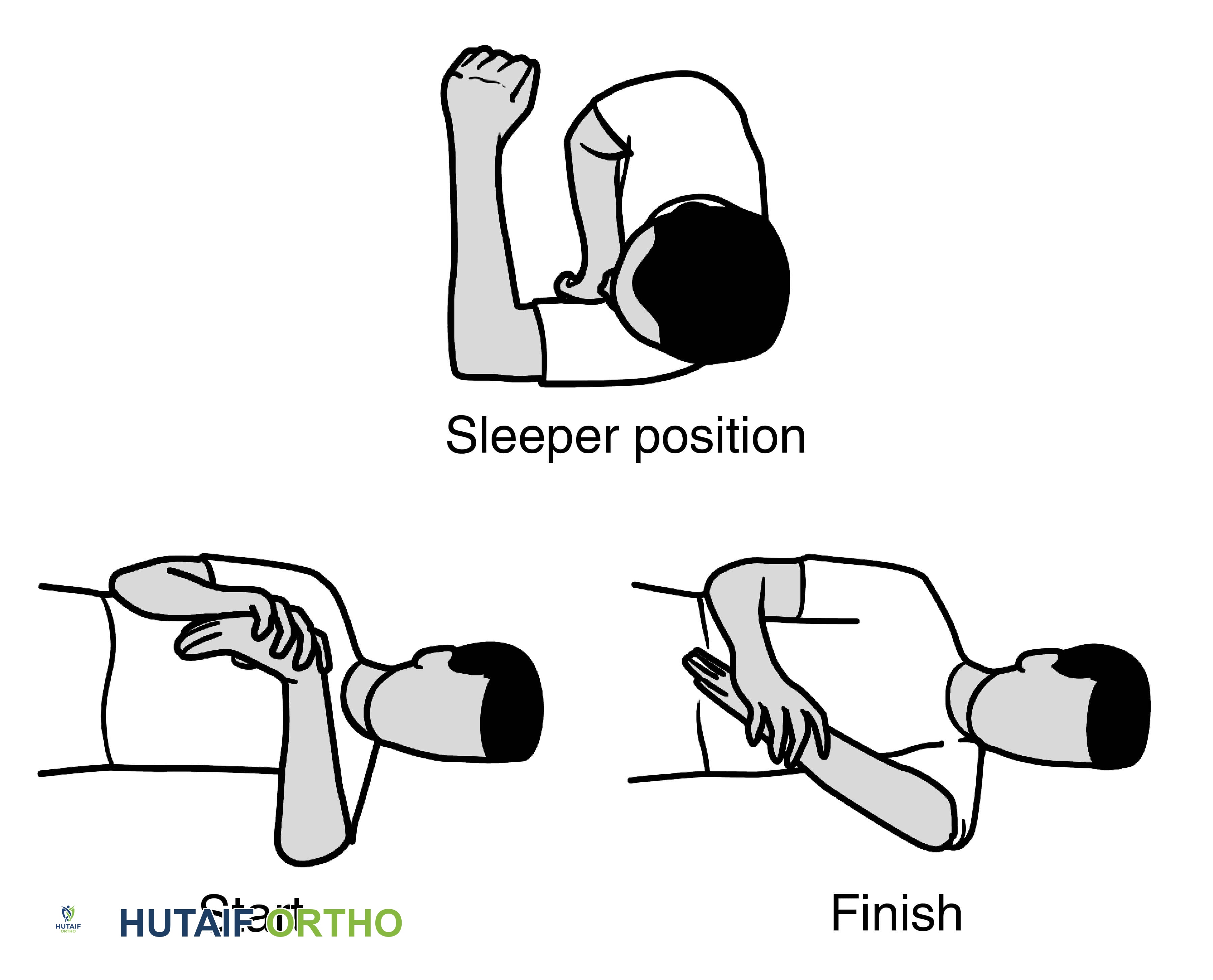 صورة طبية: تمزق الكفة المدورة بالكتف: دليلك الشامل للعلاج والتعافي مع الأستاذ الدكتور محمد هطيف في صنعاء