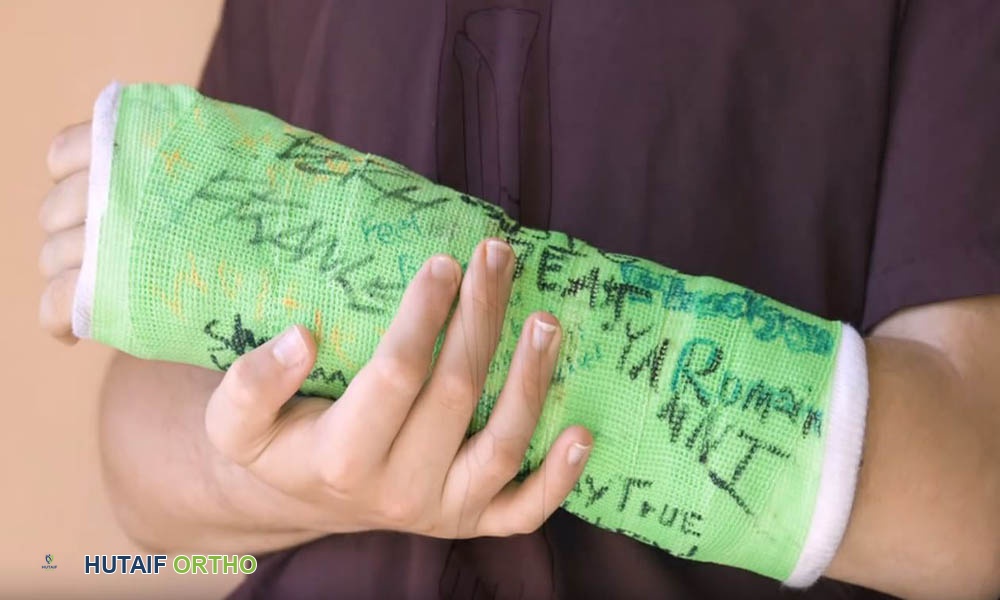 صورة توضيحية لـ دليل شامل لاستخدام العكازات والعصي والمشايات بأمان وفعالية