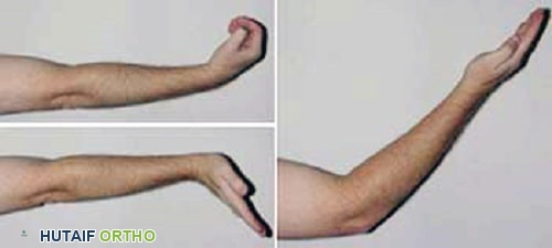 تمارين انزلاق الأعصاب