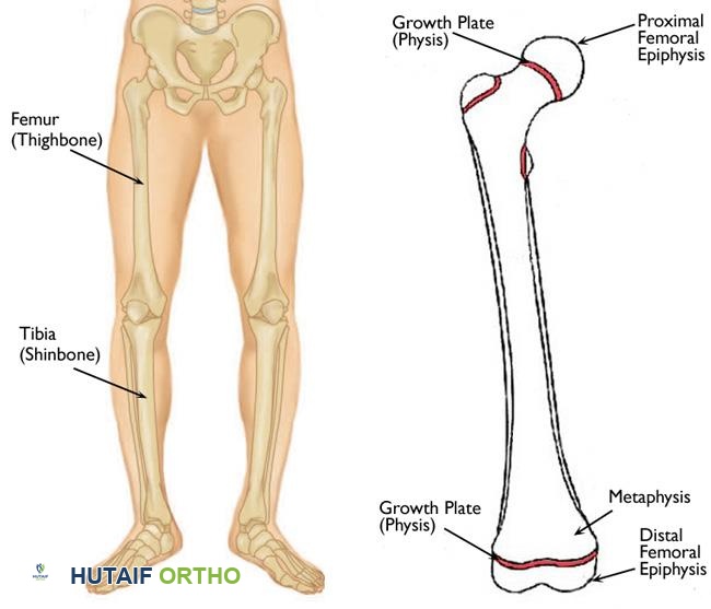 تفاوت طول الأطراف السفلية الأسباب الأعراض وخيارات العلاج المتقدمة مع الأستاذ الدكتور محمد هطيف