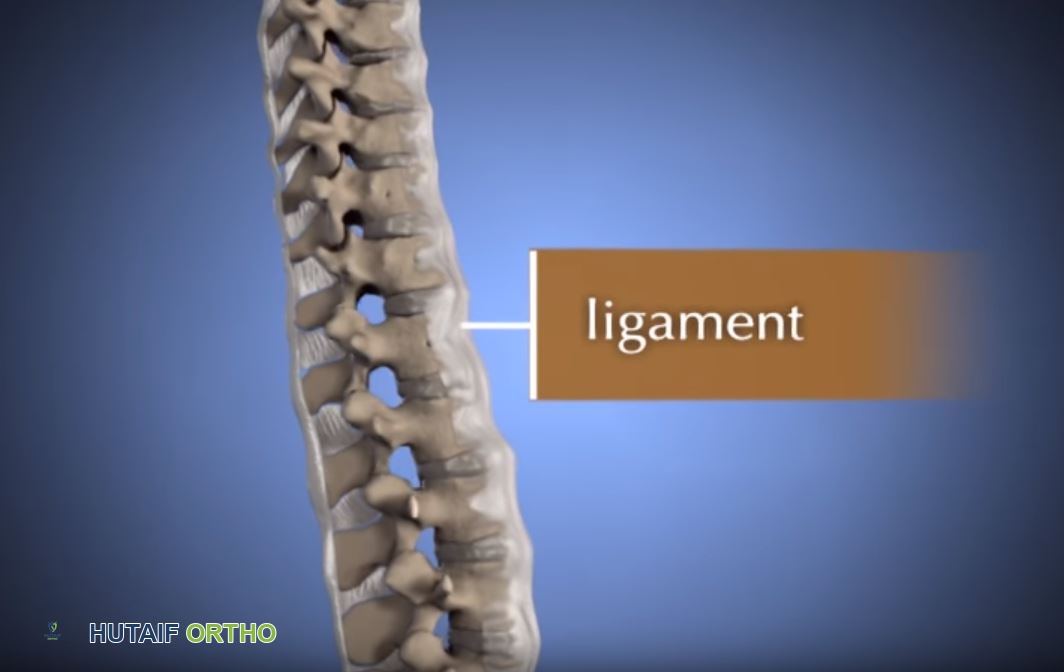 صورة طبية: الودانة (التقزم الغضروفي): دليل شامل للمرضى مع الأستاذ الدكتور محمد هطيف