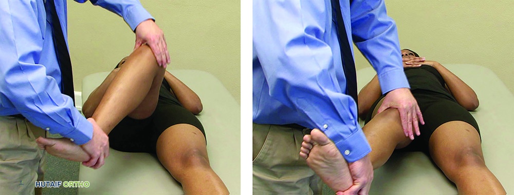 اختبار ماكموري