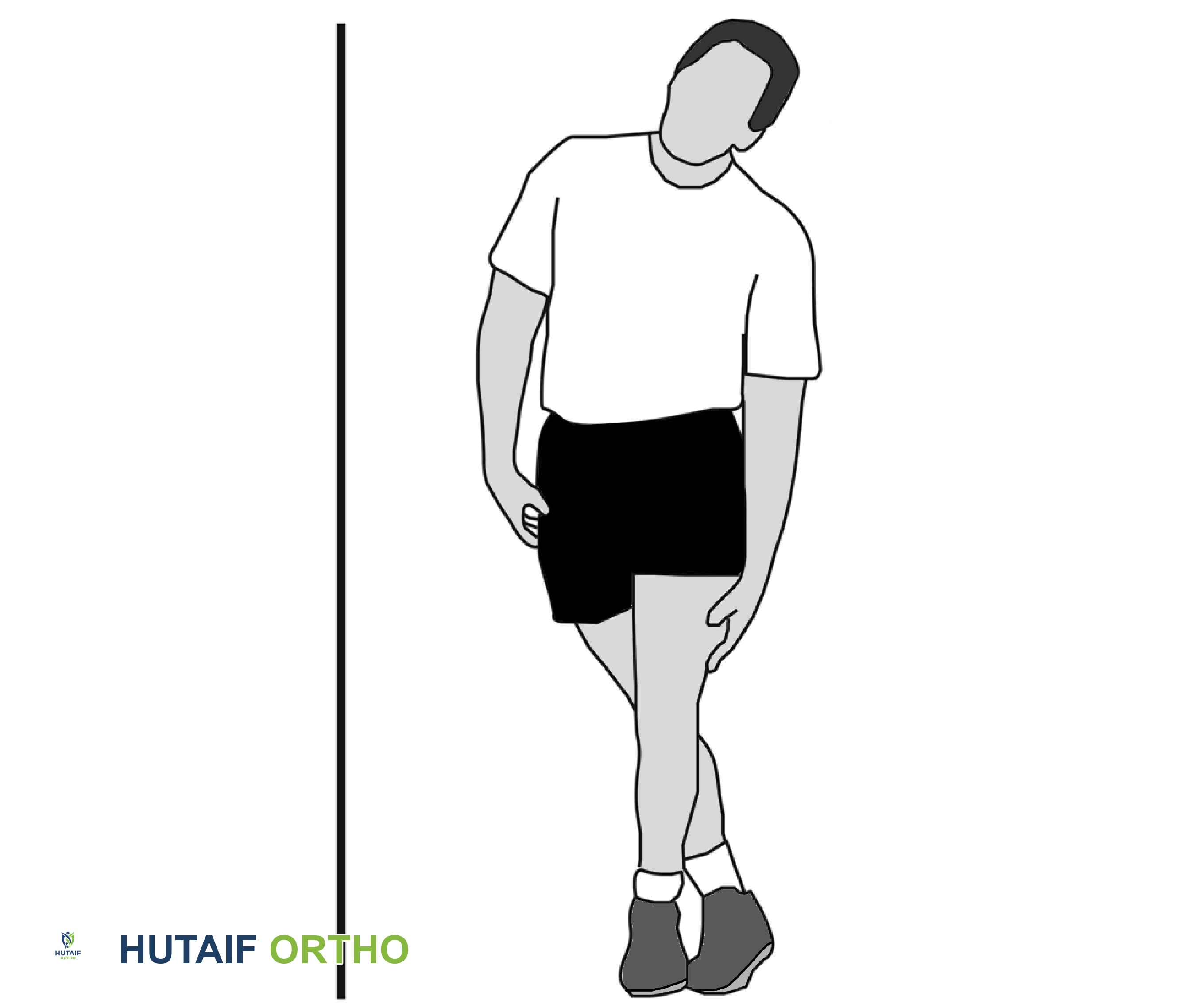 صورة توضيحية لـ الورك الطاطئ أسباب طقطقة الورك وعلاجاتها مع الأستاذ الدكتور محمد هطيف