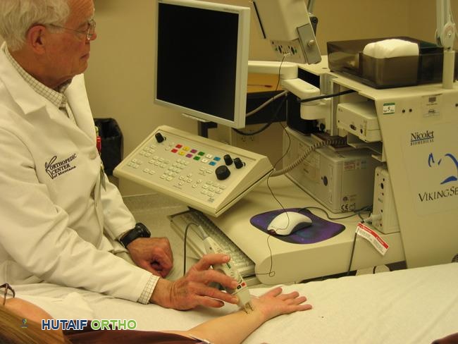 دراسة توصيل الأعصاب