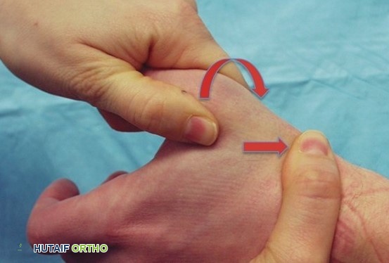 اختبار طحن المفصل الرسغي السنعي للإبهام