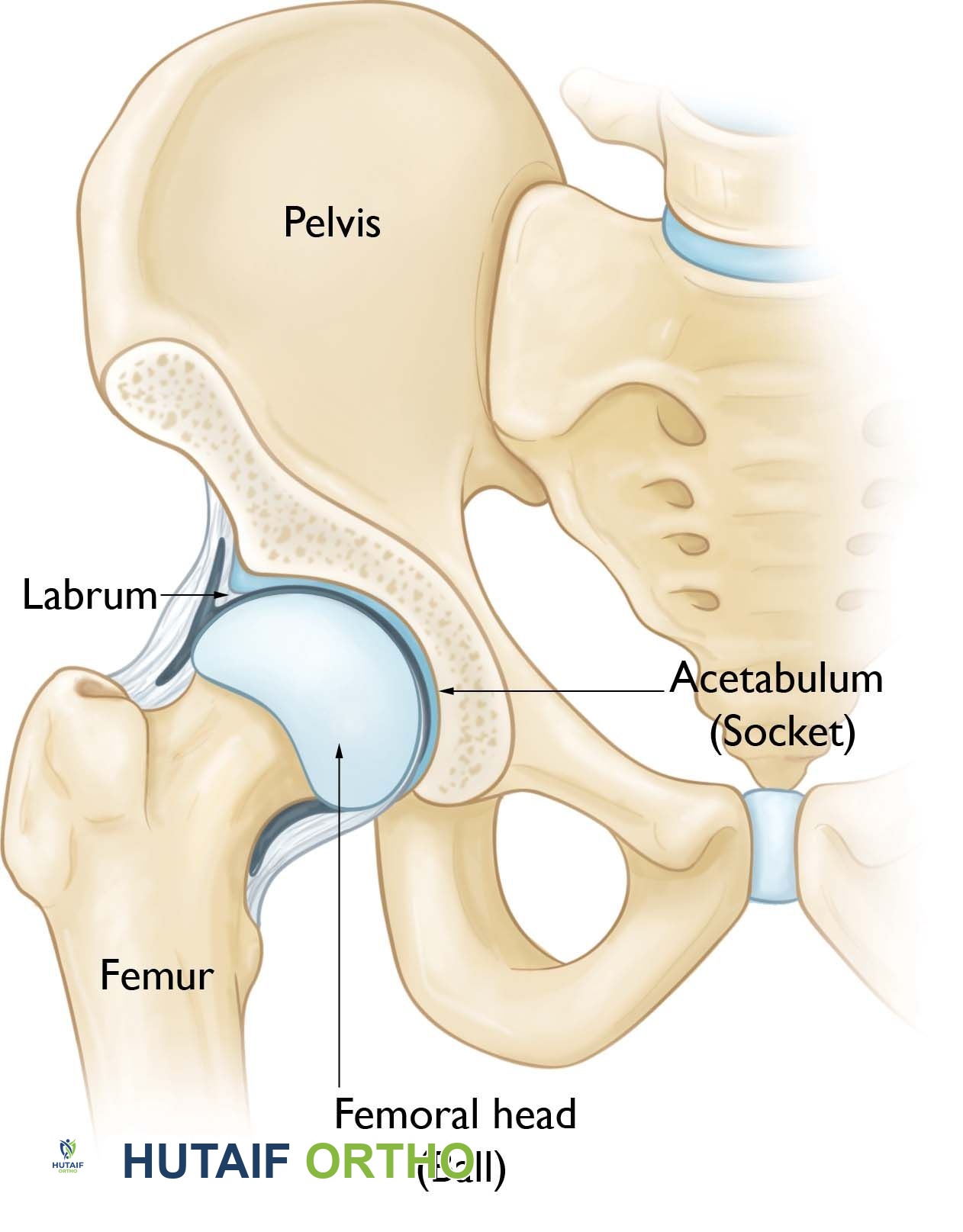 صورة توضيحية لـ الورك الطاطئ أسباب طقطقة الورك وعلاجاتها مع الأستاذ الدكتور محمد هطيف