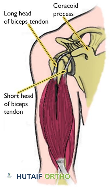 أوتار العضلة ذات الرأسين